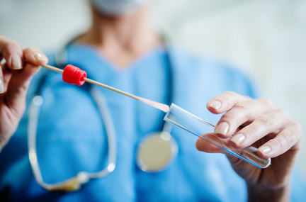 医療用植毛サンプリングスワブの製造方法